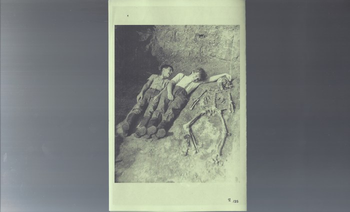 ACIDSLwarningsCVRAsmall